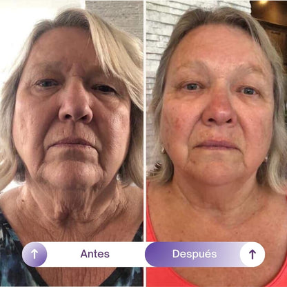 NAD+RESVERATROL - SUPLEMENTO ANTIEDAD