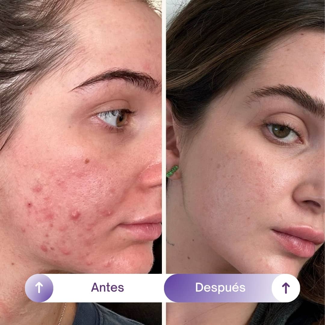 NAD+RESVERATROL - SUPLEMENTO ANTIEDAD