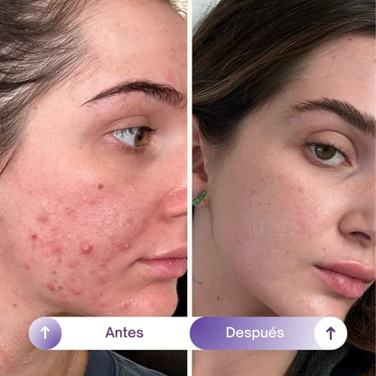 NAD+RESVERATROL - SUPLEMENTO ANTIEDAD