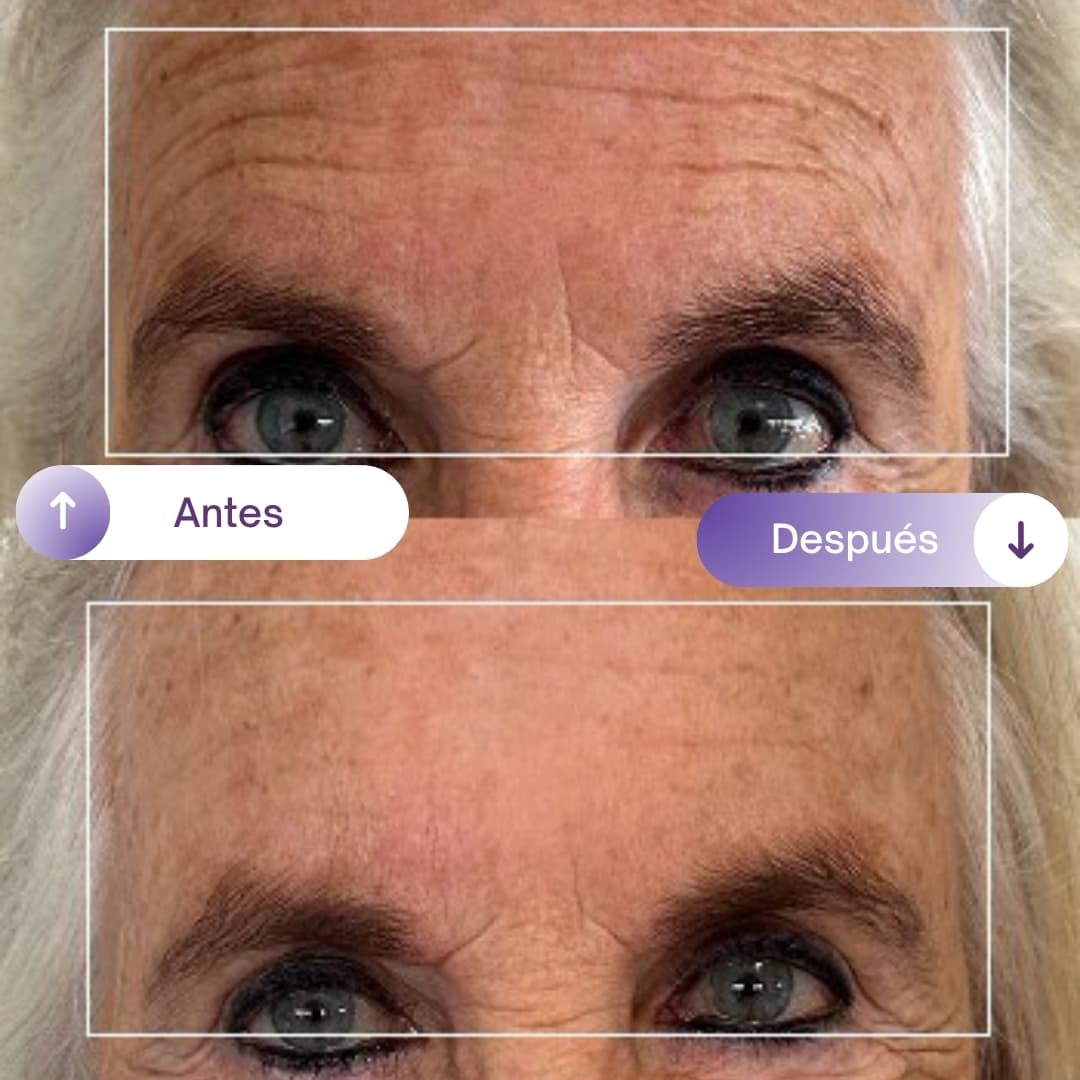 NAD+RESVERATROL - SUPLEMENTO ANTIEDAD